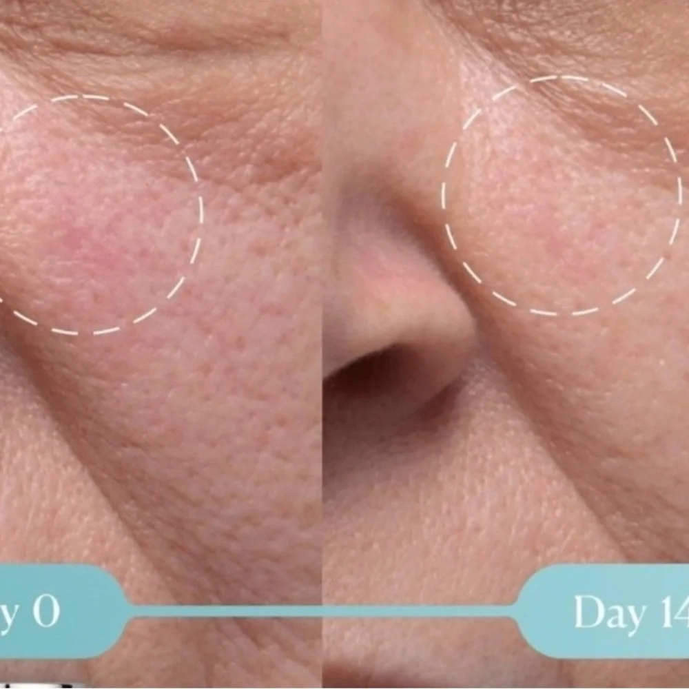 Elemis Dynamic Resurfacing Facial Pads